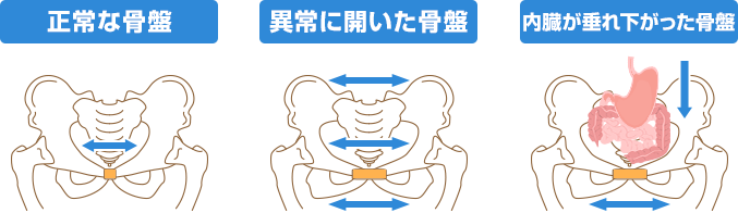 そもそもなぜ、骨盤矯正が必要なのか?